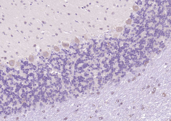 B4GALNT1/GM2 synthase Rabbit Polyclonal Antibody