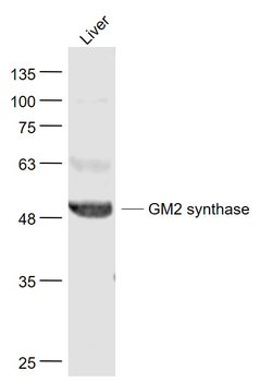 B4GALNT1/GM2 synthase Rabbit Polyclonal Antibody
