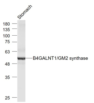 B4GALNT1/GM2 synthase Rabbit Polyclonal Antibody