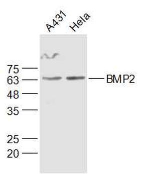 BMP2 Rabbit Polyclonal Antibody