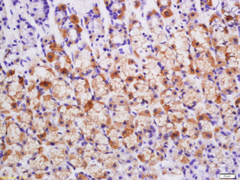 BMP2 Rabbit Polyclonal Antibody