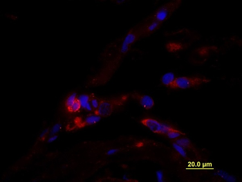 CD163 Rabbit Polyclonal Antibody