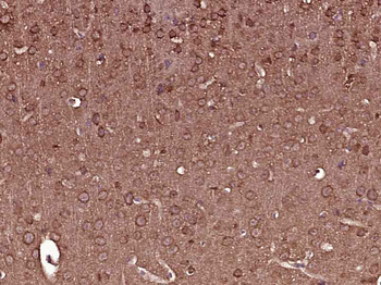 CD163 Rabbit Polyclonal Antibody