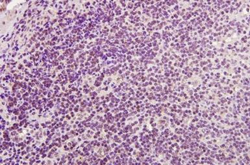 CD4 Rabbit Polyclonal Antibody