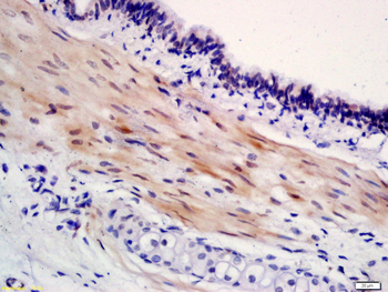 NALP3/CIAS1 Rabbit Polyclonal Antibody