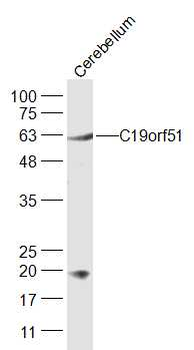 C19orf51 Rabbit Polyclonal Antibody