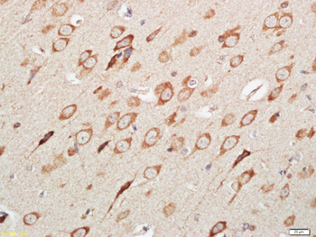 C19orf51 Rabbit Polyclonal Antibody