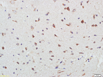 C19orf51 Rabbit Polyclonal Antibody