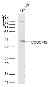 CCDC74B Rabbit Polyclonal Antibody