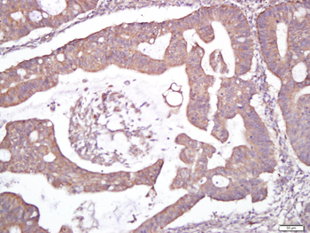 CELSR1 Rabbit Polyclonal Antibody