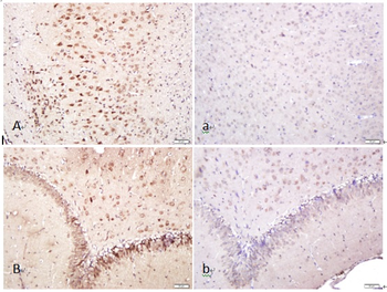 CELSR1 Rabbit Polyclonal Antibody