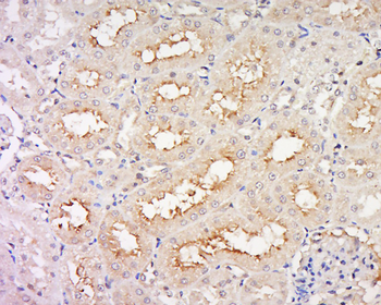 CELSR1 Rabbit Polyclonal Antibody