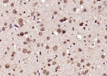 CENPJ Rabbit Polyclonal Antibody
