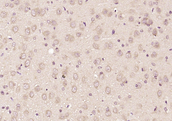 CENPJ Rabbit Polyclonal Antibody