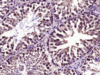 Centrin-1+Centrin-2 Rabbit Polyclonal Antibody