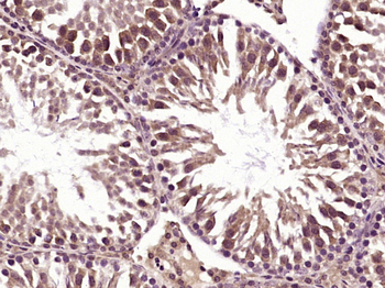 Centrin-1+Centrin-2 Rabbit Polyclonal Antibody