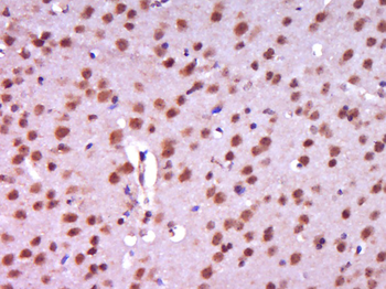 Centrin 2 Rabbit Polyclonal Antibody