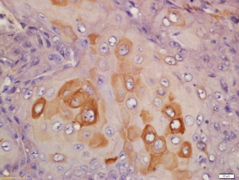 Centrin 2 Rabbit Polyclonal Antibody