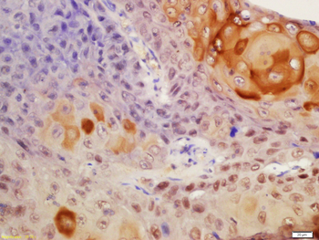 Centrin 2 Rabbit Polyclonal Antibody