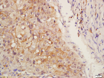 Centrin 2 Rabbit Polyclonal Antibody