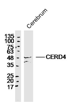 CERD4 Rabbit Polyclonal Antibody