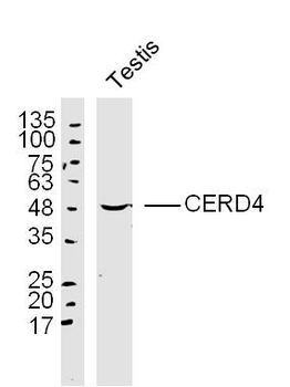CERD4 Rabbit Polyclonal Antibody