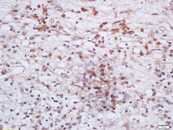 CHD8 Rabbit Polyclonal Antibody