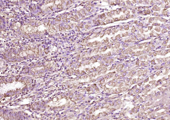 AMCase Rabbit Polyclonal Antibody