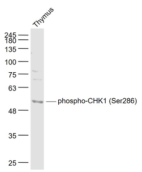 Phospho-CHEK1 (Ser286) Rabbit Polyclonal Antibody