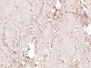 Phospho-CHEK2 (Ser28) Rabbit Polyclonal Antibody