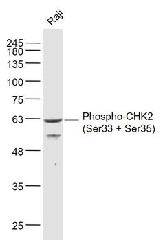 Phospho-CHEK2 (Ser33 + Ser35) Rabbit Polyclonal Antibody