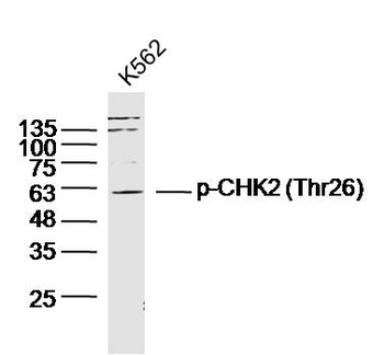 Phospho-CHEK2 (Thr26) Rabbit Polyclonal Antibody