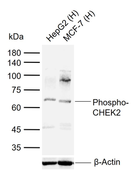 Phospho-CHEK2 (Thr26) Rabbit Polyclonal Antibody