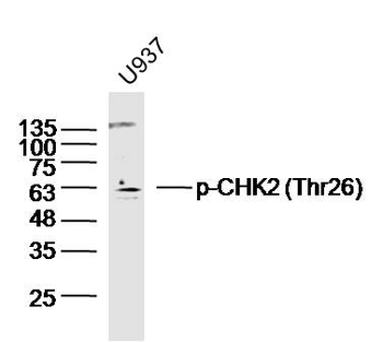 Phospho-CHEK2 (Thr26) Rabbit Polyclonal Antibody