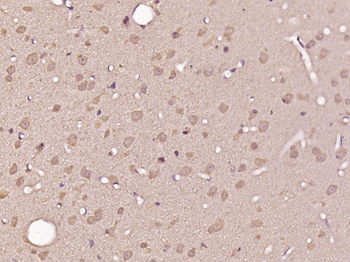 CHML Rabbit Polyclonal Antibody