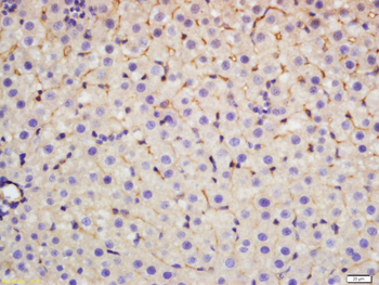 CCK39 Rabbit Polyclonal Antibody