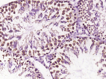 CHST3 Rabbit Polyclonal Antibody