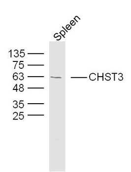 CHST3 Rabbit Polyclonal Antibody
