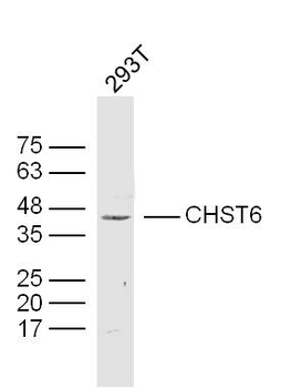 CHST6 Rabbit Polyclonal Antibody