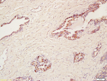 Cyclooxygenase 2 Rabbit Polyclonal Antibody