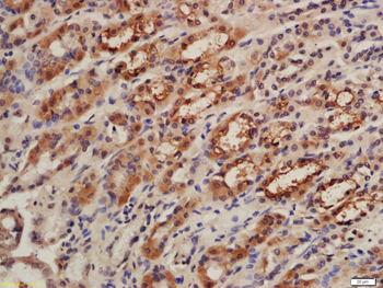 CISD1 Rabbit Polyclonal Antibody