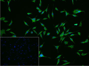 CALB1 Rabbit Polyclonal Antibody