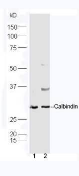 CALB1 Rabbit Polyclonal Antibody