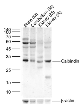 CALB1 Rabbit Polyclonal Antibody
