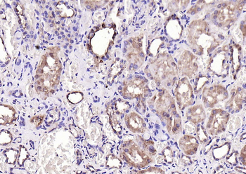 CALB1 Rabbit Polyclonal Antibody