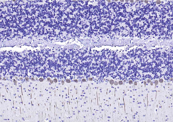 CALB1 Rabbit Polyclonal Antibody