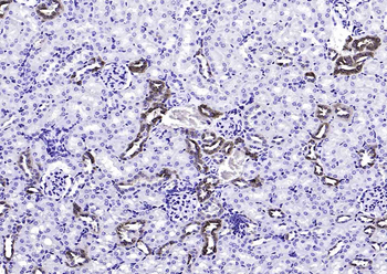 CALB1 Rabbit Polyclonal Antibody