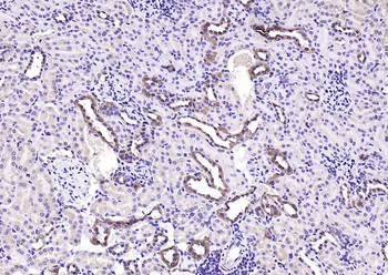 CALB1 Rabbit Polyclonal Antibody