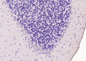 CALB1 Rabbit Polyclonal Antibody