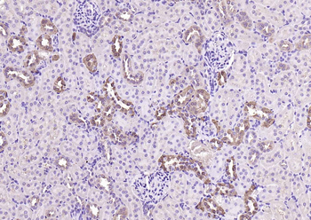 CALB1 Rabbit Polyclonal Antibody